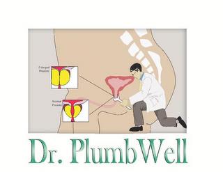 DR. PLUMBWELL ENLARGED PROSTATE NORMAL PROSTATE trademark