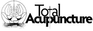 TOTAL ACUPUNCTURE trademark