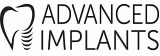 ADVANCED IMPLANTS trademark