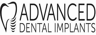 ADVANCED DENTAL IMPLANTS trademark