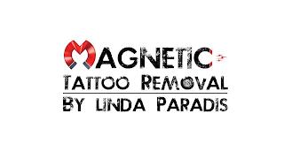 MAGNETIC TATTOO REMOVAL BY LINDA PARADIS 8 8 trademark